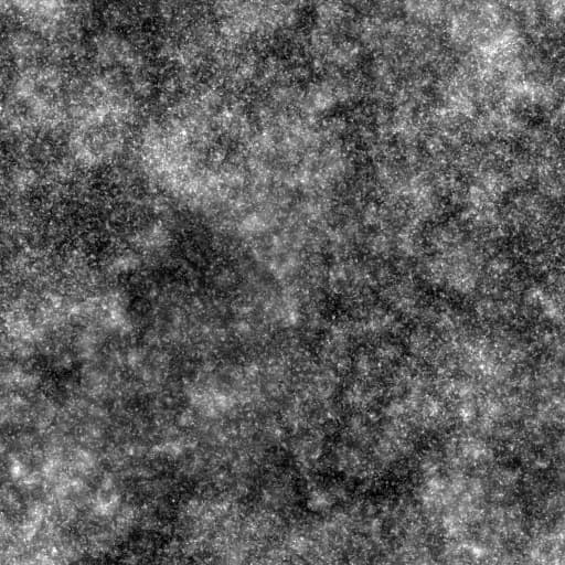 BnW spots 1 - Example 1